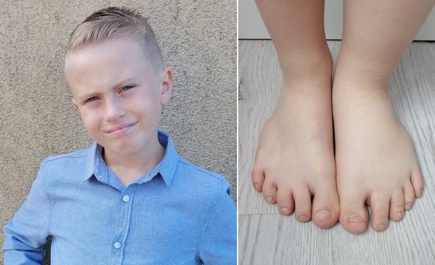 9-letni Maciej cierpi z powodu obrzęków lewej nogi. Pomogą mu regularne masaże, jednak maszyna do takich zabiegów kosztuje aż 5 tysięcy złotych.