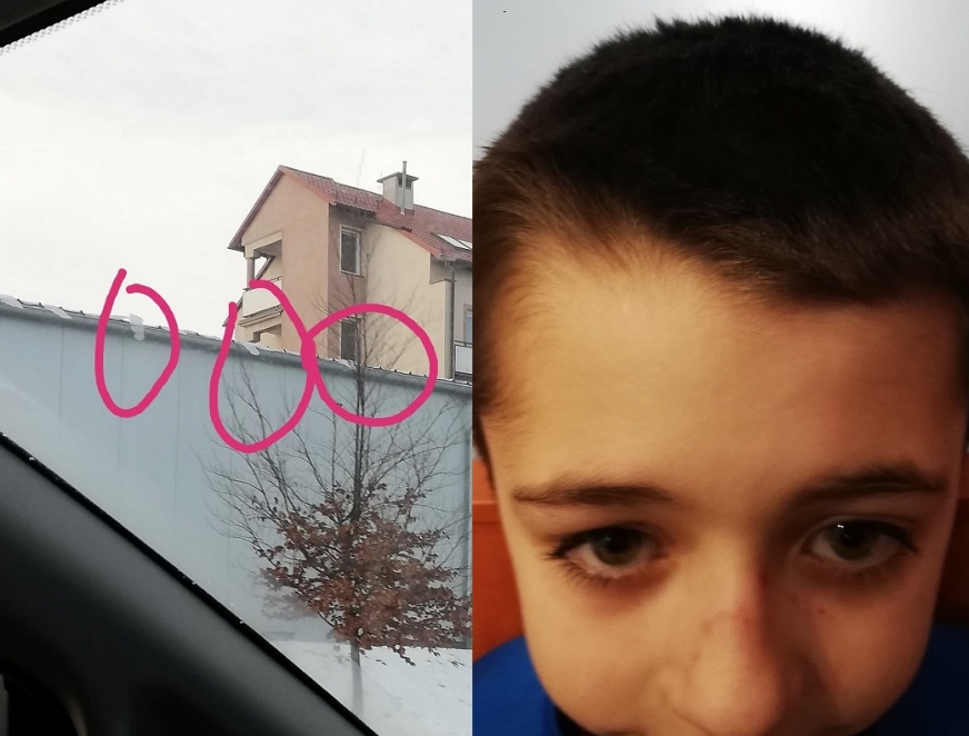 Na zdjęciu widać zwisające z dachu sklepu na ulicy Dąbrowskiego kawałki lodu. - Jeden taki kawałek spadł na nos Natana, opowiada nam rodzina.